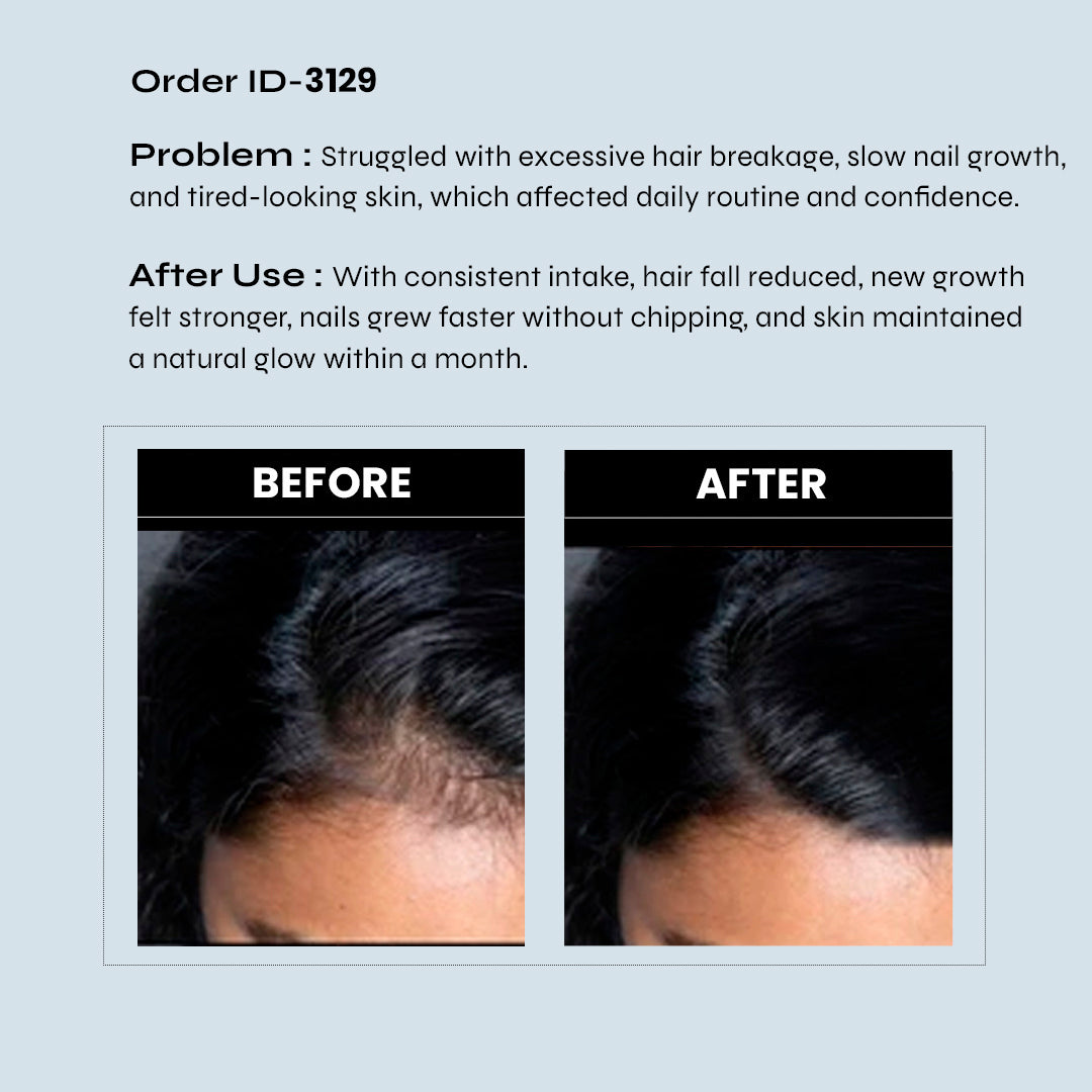 RediClinic Ultimate Skin Glow Kit | Pure Japanese Glutathione (500mg) And Biotin Collagen, Keratin (25000mcg) | RediClinic RediClinic Ultimate Skin Glow Kit | Pure Japanese Glutathione (500mg) And Biotin Collagen, Keratin (25000mcg) | RediClinic