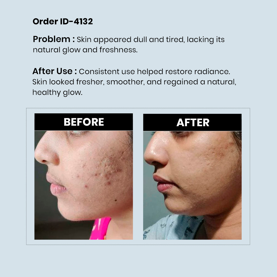 RediClinic Ultimate Skin Glow Kit | Pure Japanese Glutathione (500mg) And Biotin Collagen, Keratin (25000mcg) | RediClinic