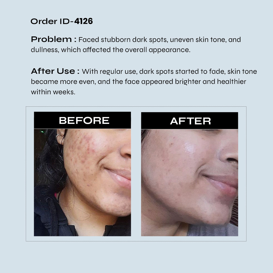 RediClinic Ultimate Skin Glow Kit | Pure Japanese Glutathione (500mg) And  Biotin Collagen, Keratin (25000mcg)