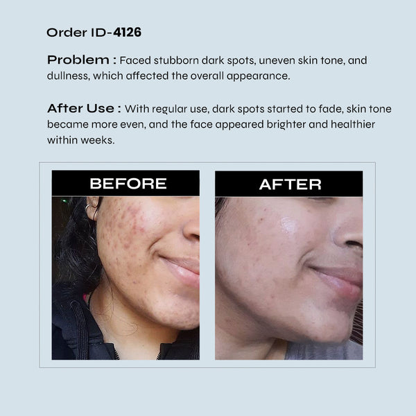 Glutathione + Vitamin C Supplement