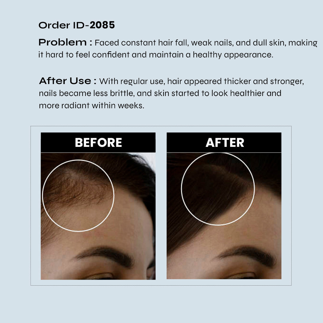 glutathione and hair loss GLUTATHIONE serum is finally here. This is the product I am the most  excited about because it does EVERYTHING. One of the most powerful  antioxidants, it's completely changed my skin and made