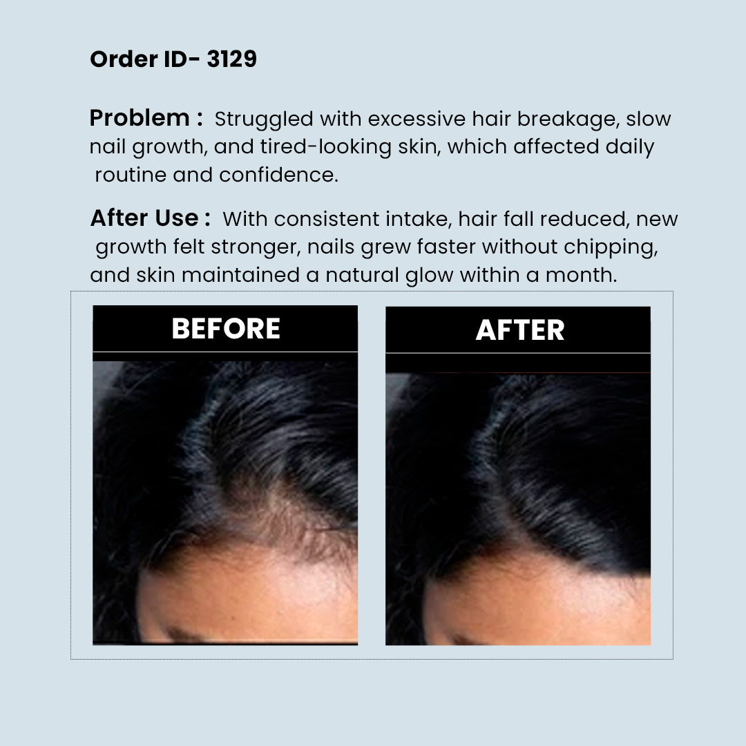 RediClinic Biotin Capsules for Men & Women | Biotin, Keratin & Collagen | Supports Hair, Skin & Nails | Boosts Skin Elasticity & Reduces Wrinkles