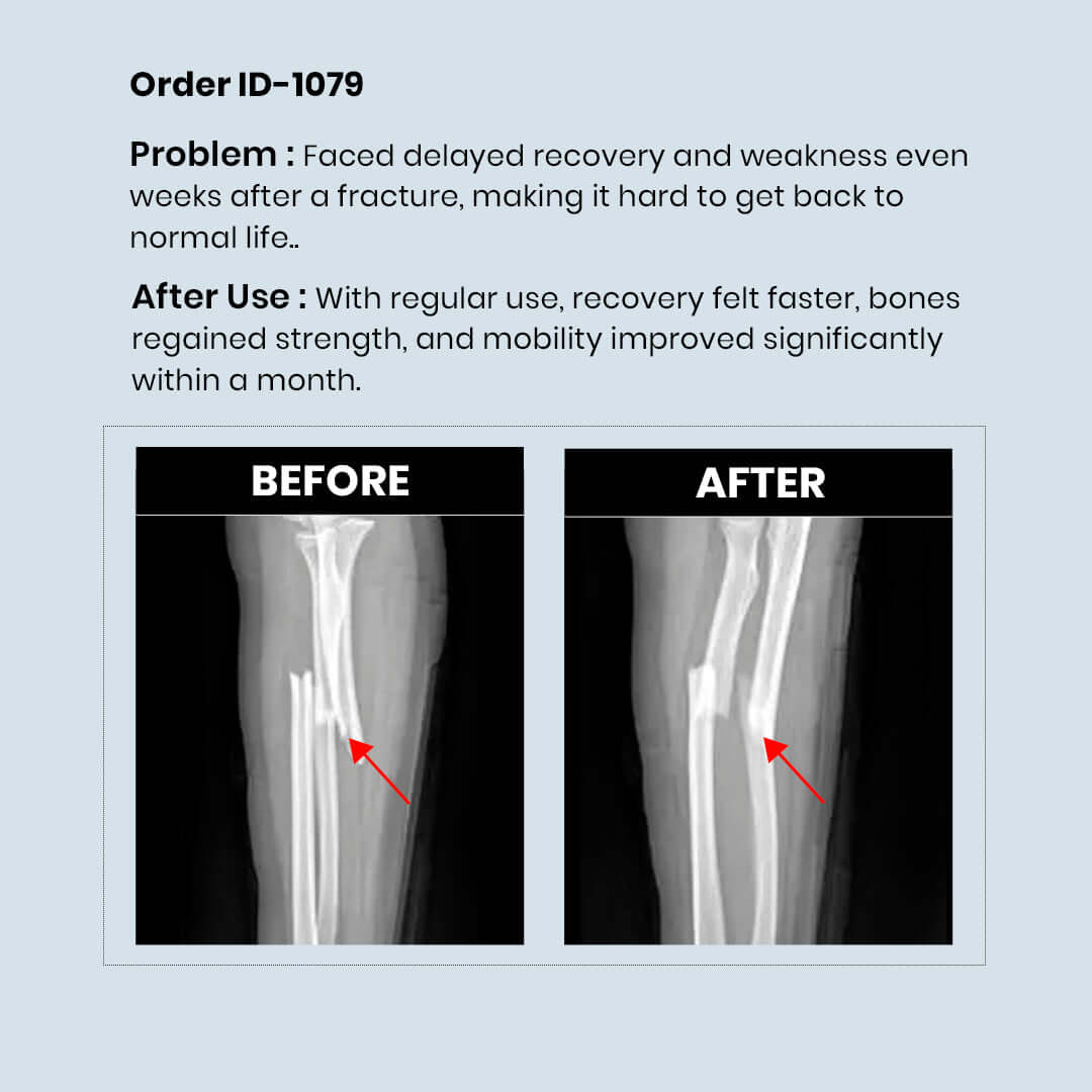 Calcium Supplement 3