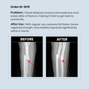 Calcium Supplement 3