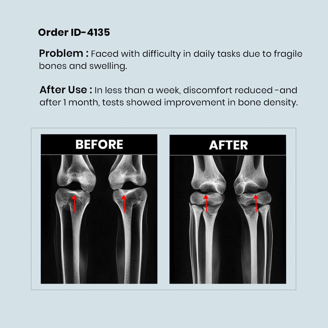 Calcium Supplement 4