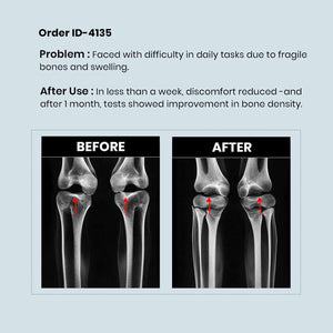 Calcium Supplement 4