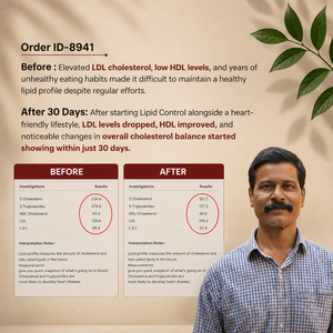 रेडिक्लिनिक लिपिड कंट्रोल – स्वस्थ कोलेस्ट्रॉल और हृदय स्वास्थ्य के लिए त्रिगुणात्मक सहायता