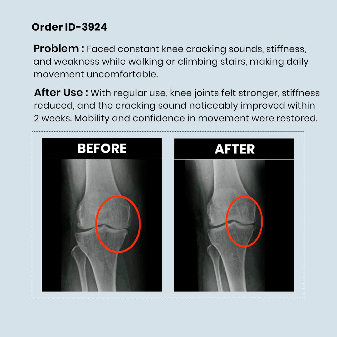 RediClinic Flexi Strength | The World's No.1 Combo for Total Bone and Joint Health at Age 35+!