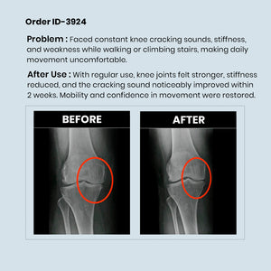 RediClinic Flexi Strength | The World's No.1 Combo for Total Bone and Joint Health at Age 35+!