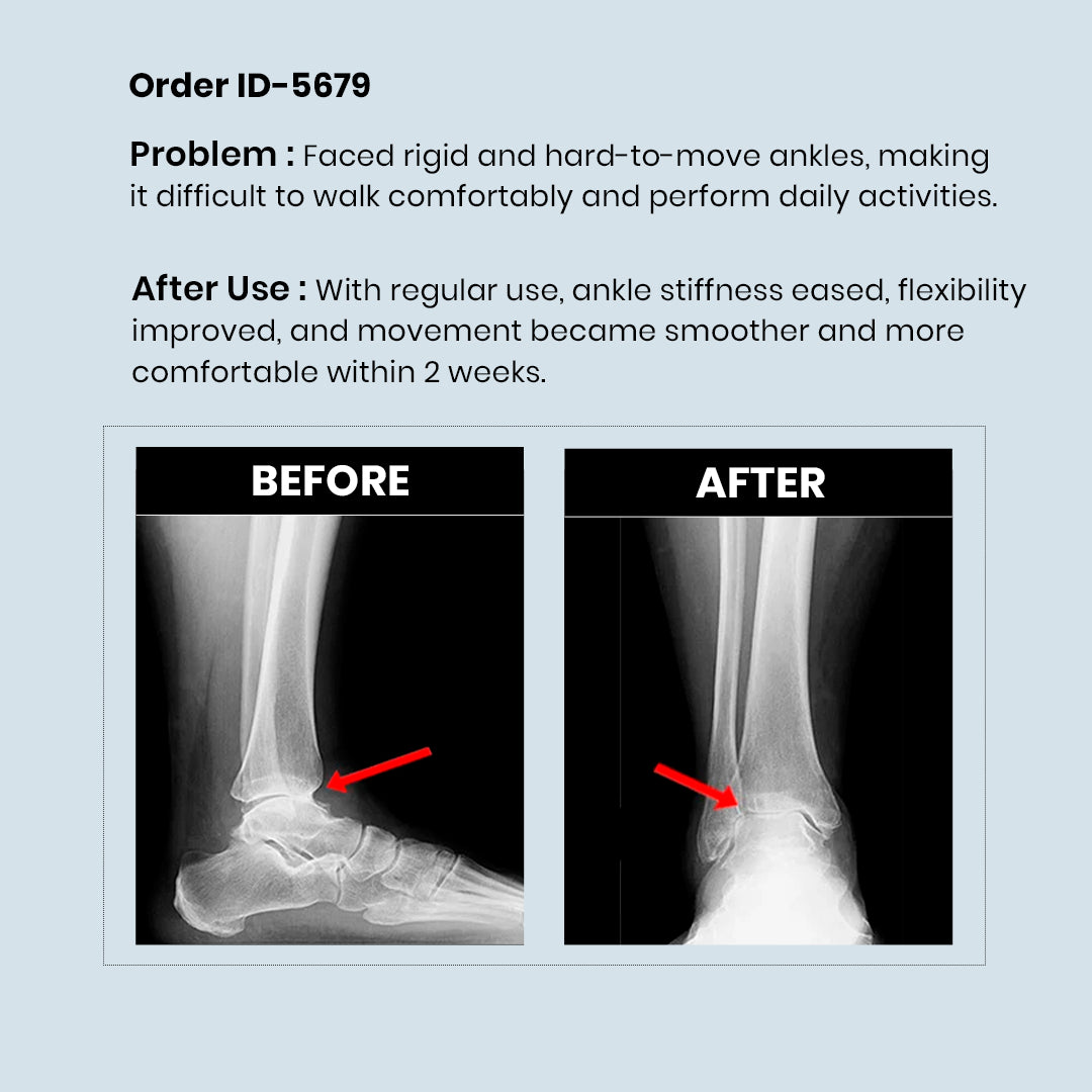 RediClinic Flexi Strength | The World's No.1 Combo for Total Bone and Joint Health at Age 35+!