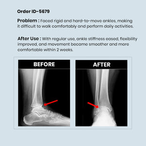 RediClinic Flexi Strength | The World's No.1 Combo for Total Bone and Joint Health at Age 35+!