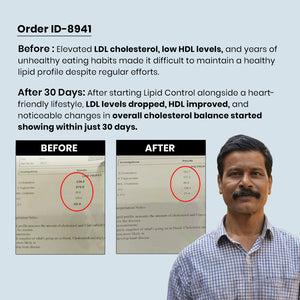 रेडिक्लिनिक लिपिड कंट्रोल – स्वस्थ कोलेस्ट्रॉल और हृदय स्वास्थ्य के लिए त्रिगुणात्मक सहायता