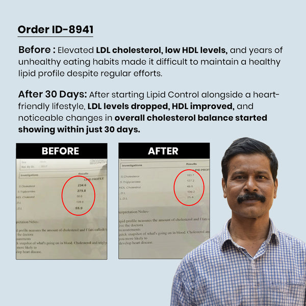 रेडिक्लिनिक लिपिड कंट्रोल – स्वस्थ कोलेस्ट्रॉल और हृदय स्वास्थ्य के लिए त्रिगुणात्मक सहायता